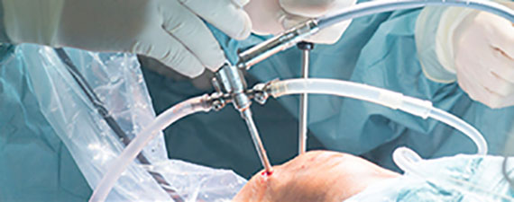 'Curso Aniversario Ortopedia y Traumatología - Hospital San José 85 años', gratuito