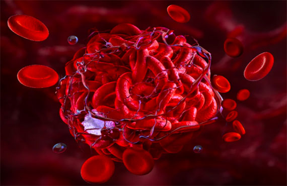 'Curso de anticoagulación en escenarios cardiovasculares', virtual sincrónico