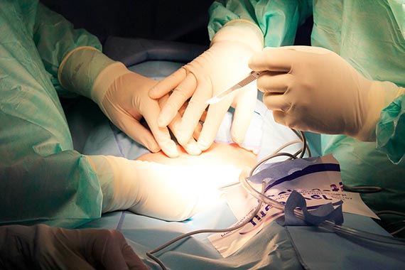 El ministro de Salud alerta sobre el aumento de cesáreas en Colombia