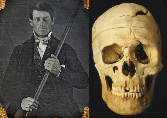 El famoso accidente de Phineas Gage