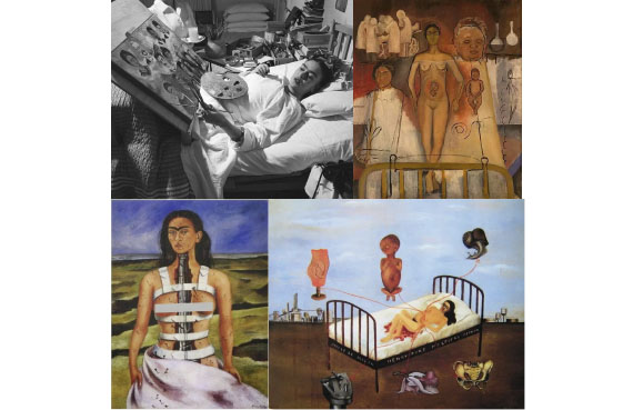 Frida Kahlo y su pintura autobiográfica sobre el dolor