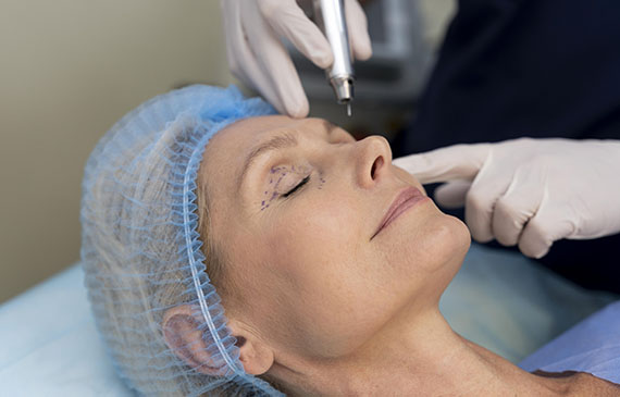 Rejuvenecimiento facial: ¿cómo elegir entre tratamientos estéticos no invasivos y procedimientos quirúrgicos? 