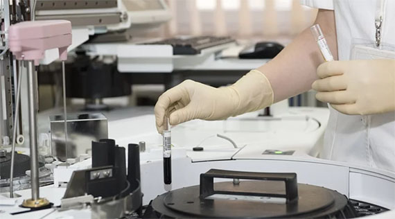 'Pruebas de laboratorio para el nuevo coronavirus de 2019 (2019-nCoV)', información de la OMS