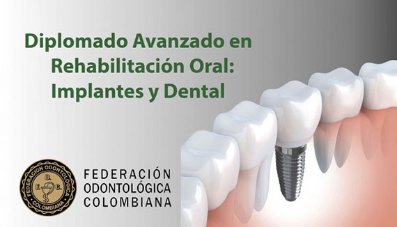 Diplomado avanzado en rehabilitación oral: Implantes y dental