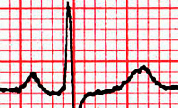 EKG - curso completo, gratis, virtual y en español