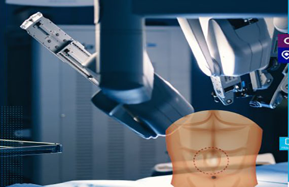 'III Encuentro de hernias de la pared abdominal', virtual