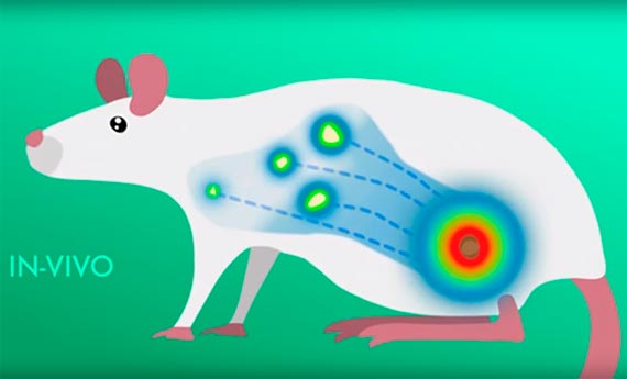 Investigadores logran visualizar metástasis del melanoma antes de que ocurran