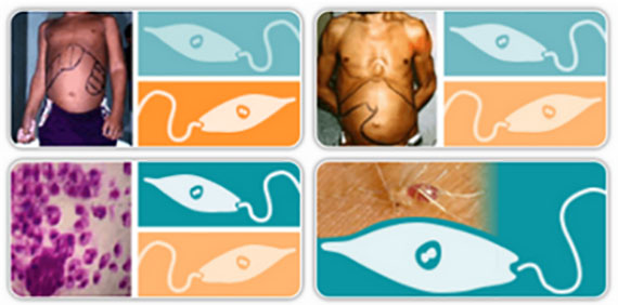 Curso gratuito y virtual 'Leishmaniasis Visceral en las Américas: diagnóstico y tratamiento'