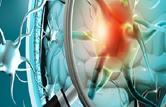 'Maestría en Neuoropsicología', virtual
