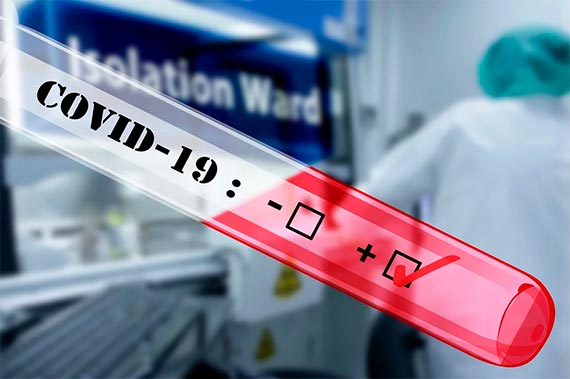Nueve nuevos casos confirmados de COVID-19, el total en Colombia ya es de 102