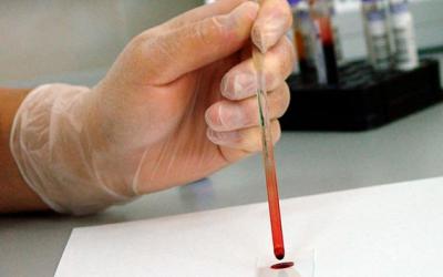 El Invima publica nuevas disposiciones sobre estudios de biodisponibilidad y bioequivalencia