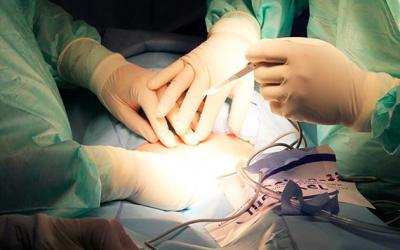 El ministro de Salud alerta sobre el aumento de cesáreas en Colombia