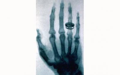 Roentgen, hace visible lo invisible