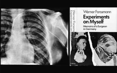 Werner Forssmann y el primer cateterismo cardiaco
