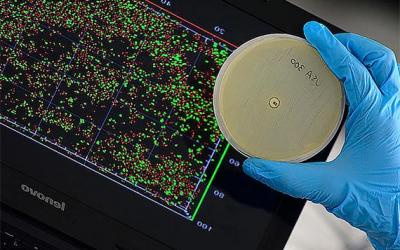 Software desarrollado en la Universidad Nacional identifica rápidamente bacterias en ambientes clínicos