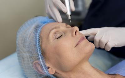 Rejuvenecimiento facial: ¿cómo elegir entre tratamientos estéticos no invasivos y procedimientos quirúrgicos?  - El Diario de Salud