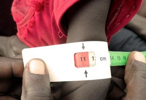 El 22,9% de los menores de 5 años del mundo padece desnutrición crónica y el 6% tiene sobrepeso