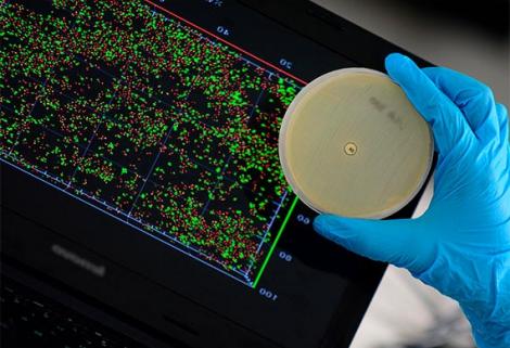 Secuencian genoma de superbacteria Acinetobacter baumannii en la Universidad Nacional