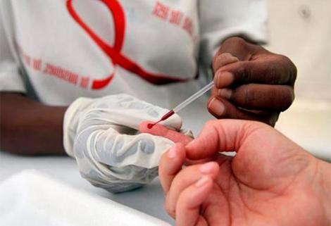 Se ha diagnosticado más del 72% de personas viven con VIH en el país, según MinSalud. 