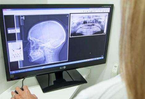 Fallan los servicios de imágenes diagnósticas en sistema de salud