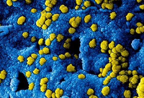 Imagen del coronavirus del Instituto Nacional de Enfermedades Alérgicas e Infecciosas de Estados Unidos