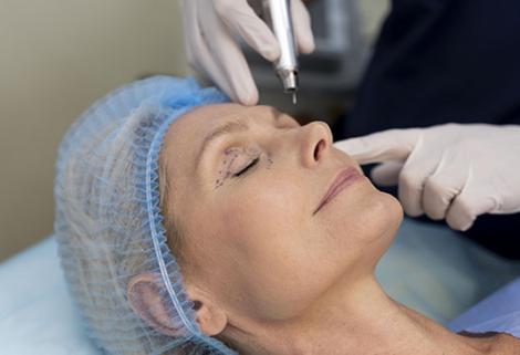 Rejuvenecimiento facial: ¿cómo elegir entre tratamientos estéticos no invasivos y procedimientos quirúrgicos?  - El Diario de Salud