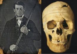 El famoso accidente de Phineas Gage -Cátedra - El Diario de Salud