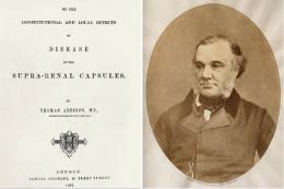 Thomas Addison y la enfermedad de bronce, que lleva su nombre - Cátedra - El Diario de Salud 